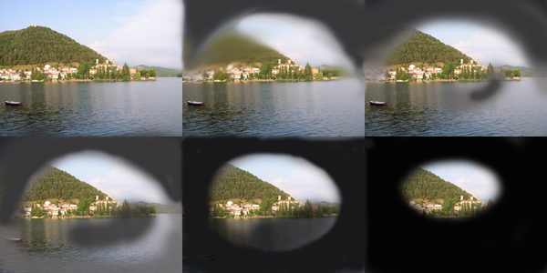 Resultado de imagen de campo visual glaucoma